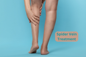 Spider Vein Treatment: Get Better Looking Legs.